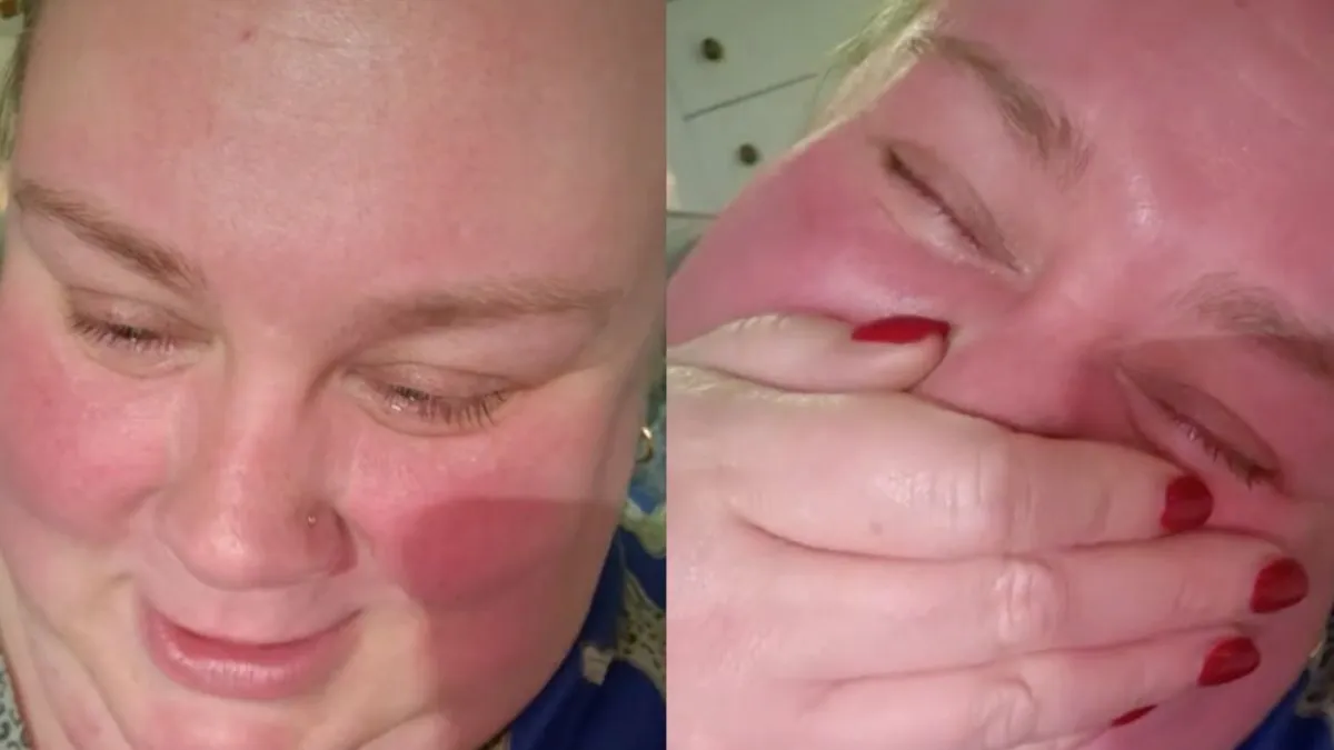 thumb lauren darts
