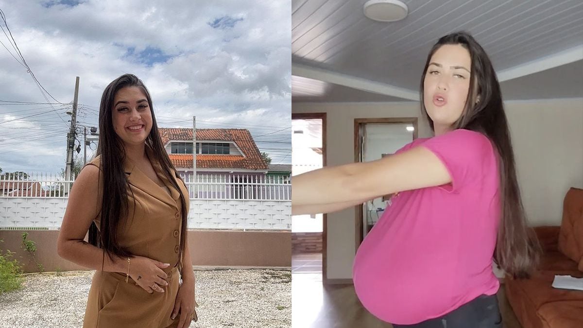 21-jarige vrouw uit Brazilië ondergaat een gigantische borstverkleining