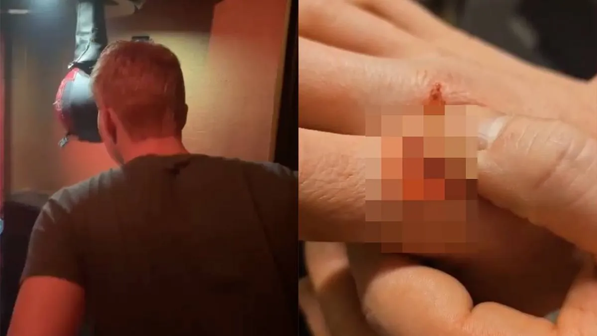 thumb vk gast raakt boksbal verkeerd en kan daarna naar de pees van zijn vinger kijken