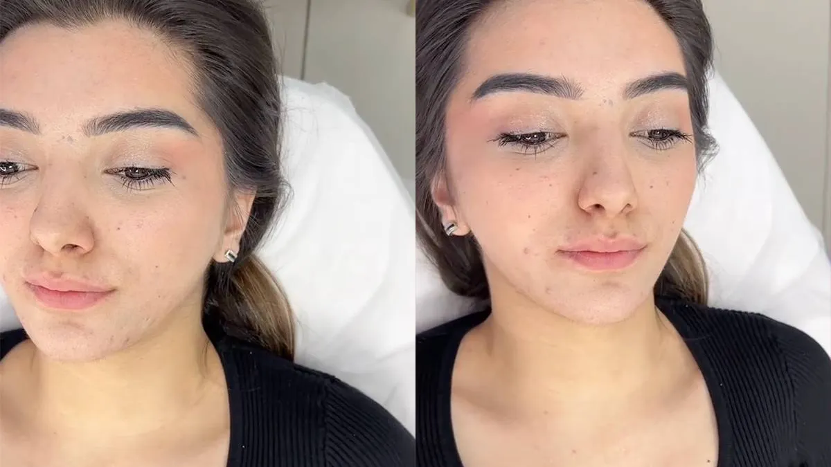 thumb vk vrouw heeft zich laten verbouwen en dat had ze beter niet kunnen doen