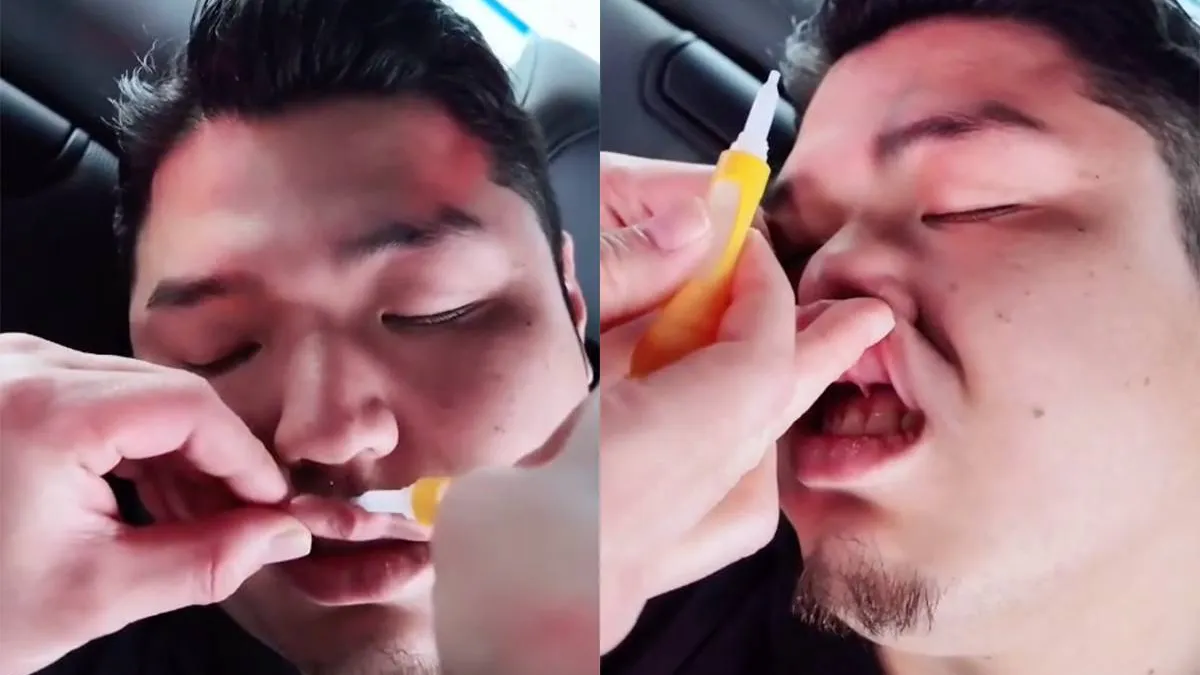 thumb vk leuke vrienden heb je dan spelen met lijm op de lip