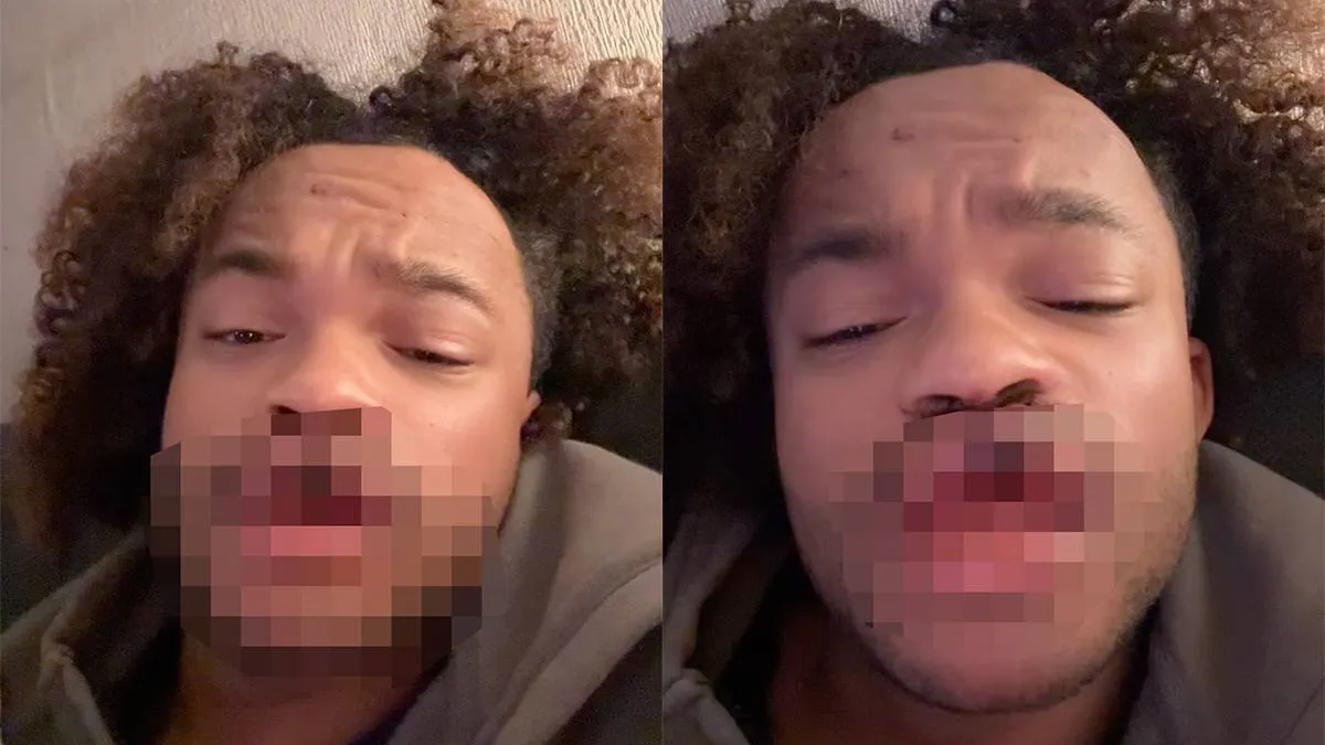 thumb_vk_Man_heeft_geen_lipfillers_maar_wel_een_avondje_Korte_Leidsedwarsstraat_achter_de_rug