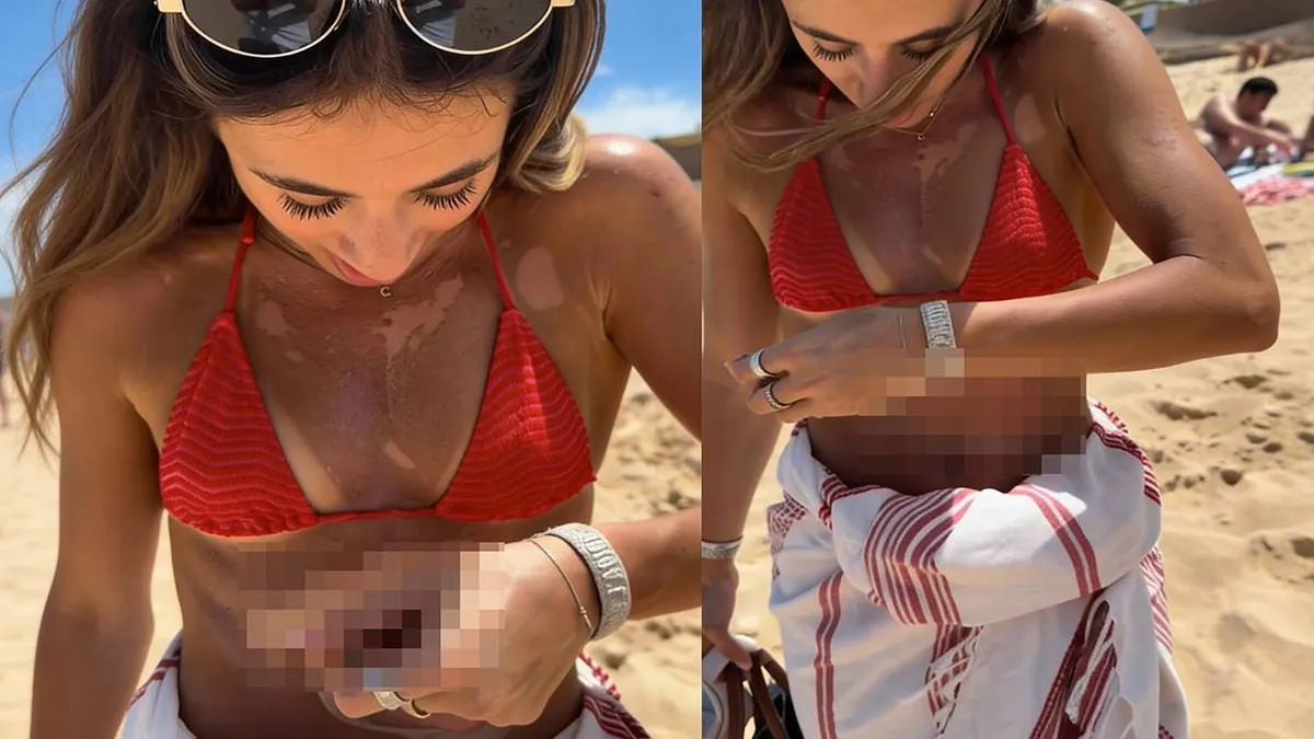 thumb_vk_Er_bestaat_dus_zoiets_als_te_veel_zon_pakken