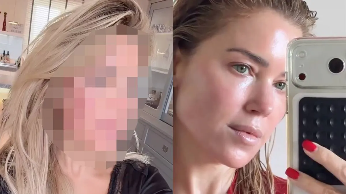 thumb_vk_Sylvie_Meis_dagen_uit_de_roulatie_na_zware_laserbehandeling