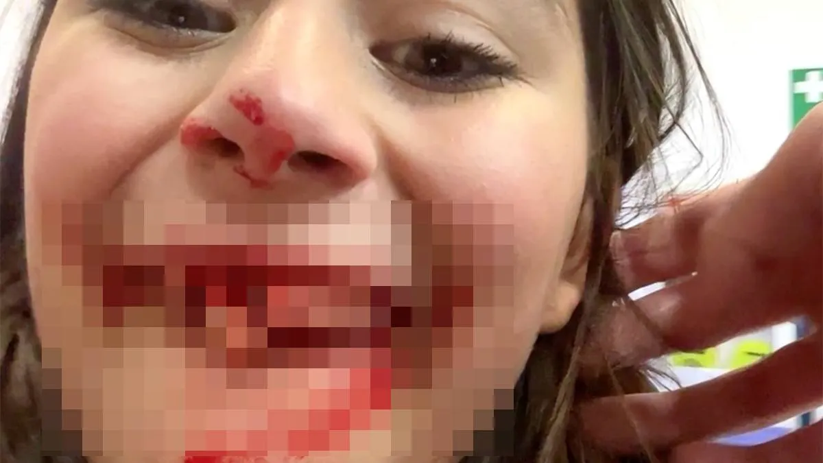 thumb_vk_Superman_slaat_toe_in_Kielegat_tanden_eruit_na_carnavalsklap