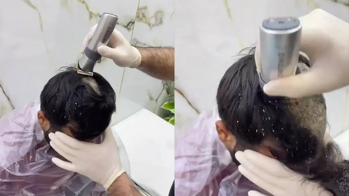 thumb_vk_Jeuk_op_het_hoofd_blijkt_een_compleet_horrorverhaal