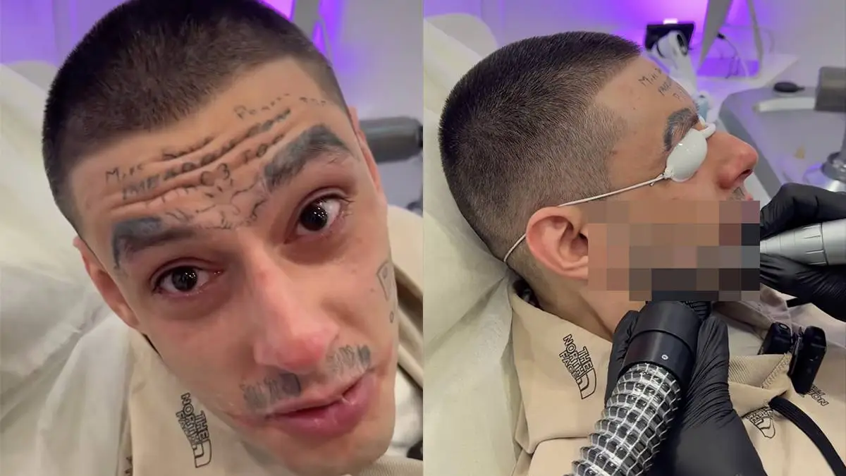 thumb_vk_spijt_tattoo_weghalen