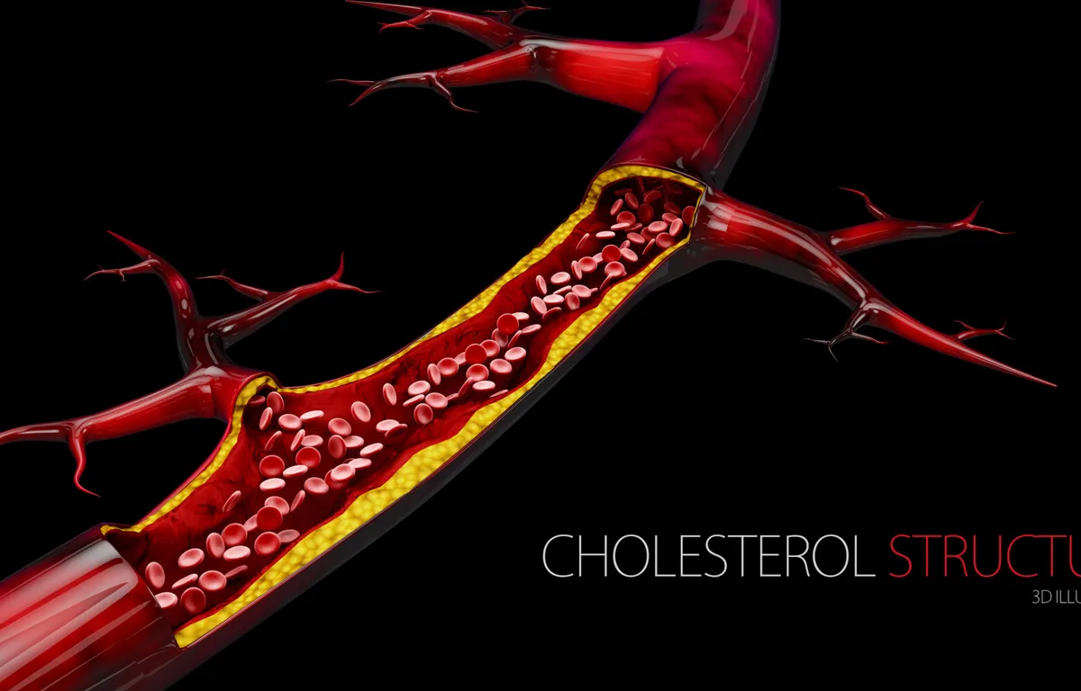 “Il colesterolo diventa pericoloso solo se una quantità eccessiva finisce nel posto sbagliato.”