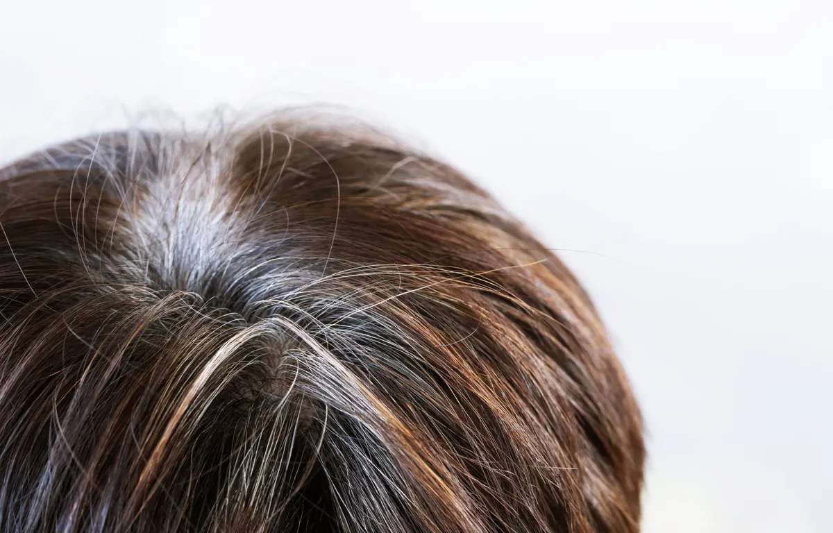 Science-Backed Ways to Delay Gray Hair | Nutrition, Stress, and Hair Care Tips