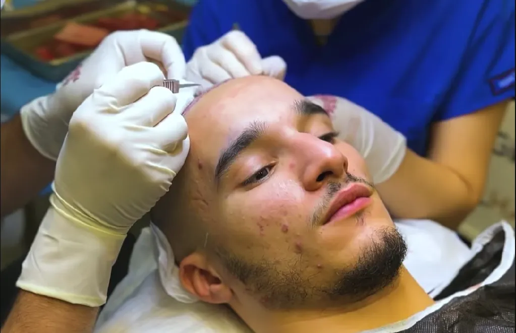 Oussama 'Muis' Ahammoud laat haarlijn herstellen en neemt fans mee in