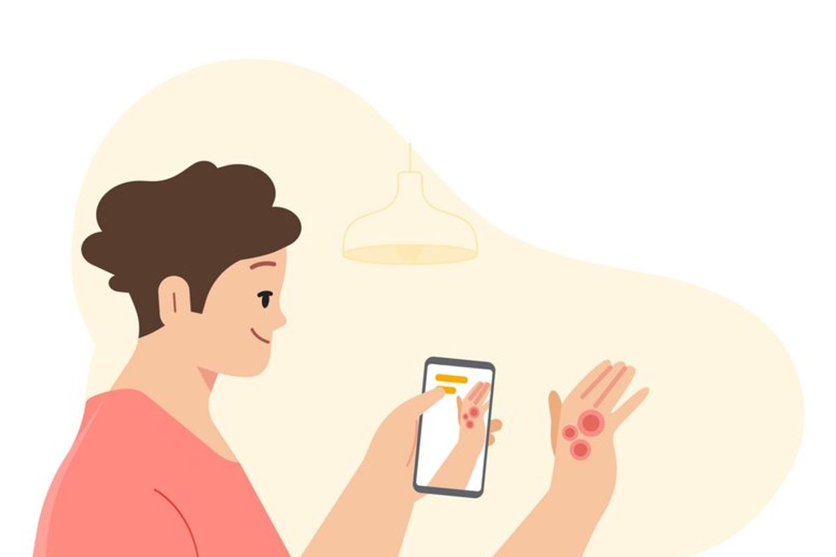 Zo gaat Google jou helpen om huidkanker op te sporen