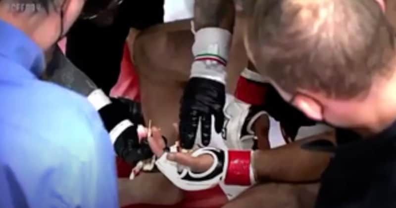 VIDEO. MMA-vechter verliest vinger in de octagon!