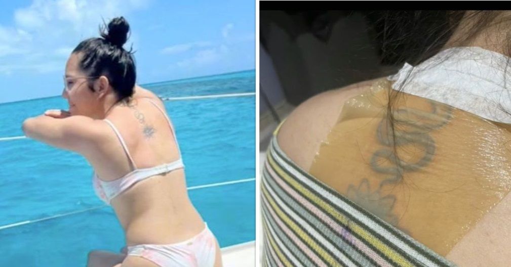 Jongedame gaat met nieuwe tattoo meteen zonnebaden en zwemmen, met dramatische gevolgen