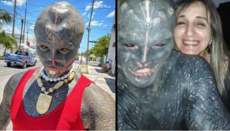 'Black Alien', die nu een been wil laten amputeren, zegt dat zijn moeder accepteert wie hij is