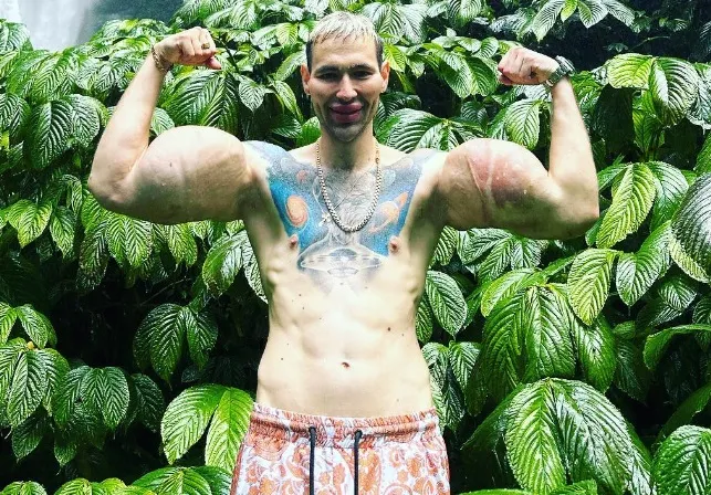 Russische Popeye beklaagt olie-injectie in biceps en geeft toe dat schade niet hersteld kan worden