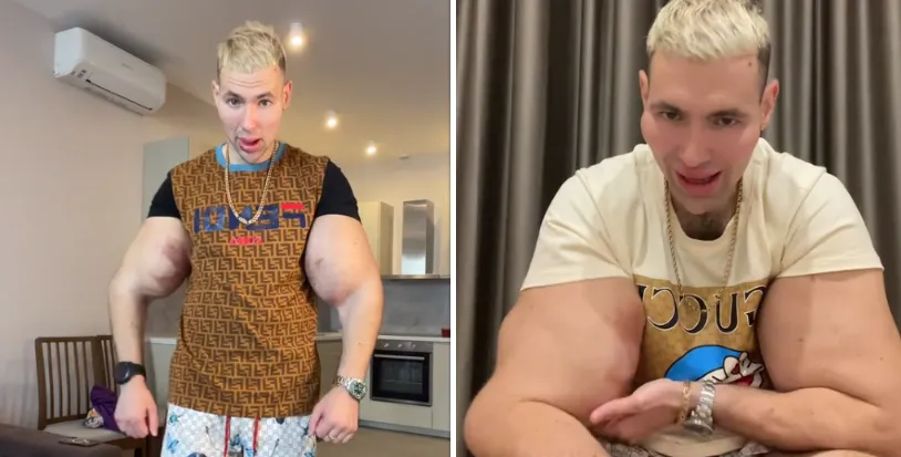 De 'Russische Popeye' showt nog eens zijn enorme nepbiceps in bizar filmpje: "Ze gaan barsten, bro!"