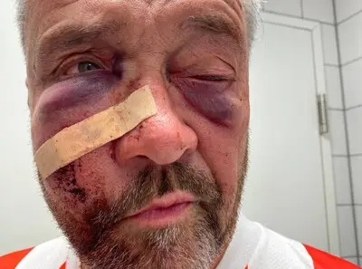 Anthony (61) toegetakeld tijdens kampioensfeest van PSV, stiefdochter begint inzamelingsactie