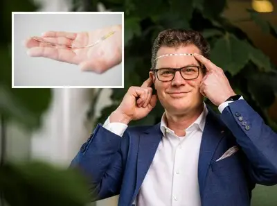 Eindhovens bedrijf krijgt 53 miljoen euro voor implantaat tegen migraine