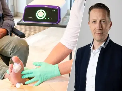 Bliksemsnelle techniek uit Eindhoven: duizenden ouderen straks sneller van stinkende wonden af