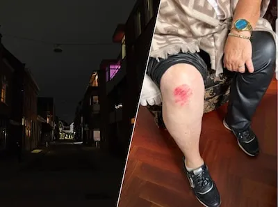 Kapotte straatverlichting zorgt voor bloedende knie en boze bewoners in Tilburgse straat: ‘Is geen veilig gevoel’
