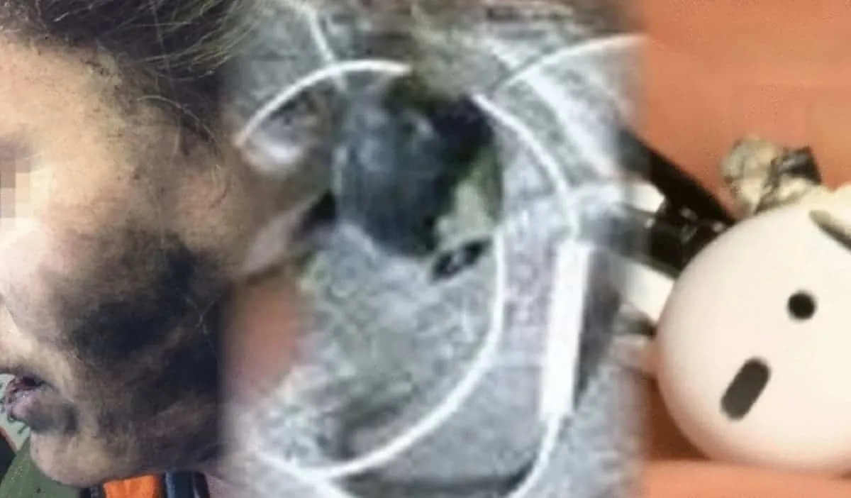 An explosion of Bluetooth headphones during use killed a person