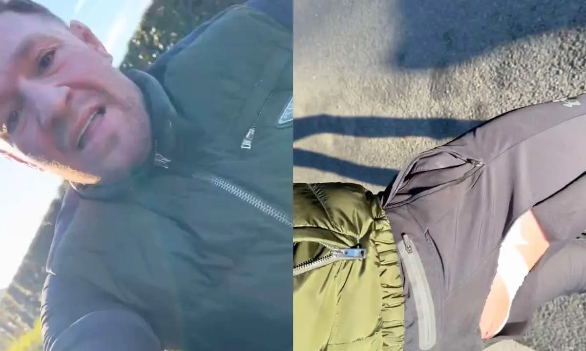 Conor McGregor aangereden door auto, pakt telefoon en begint alles te filmen