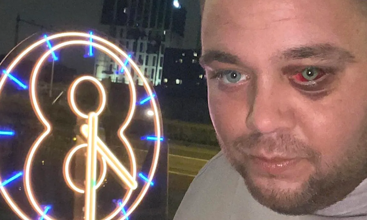 Zoon Peter Gillis ziet er ineens beroerd uit: 'Wat is er met Mark gebeurd?'