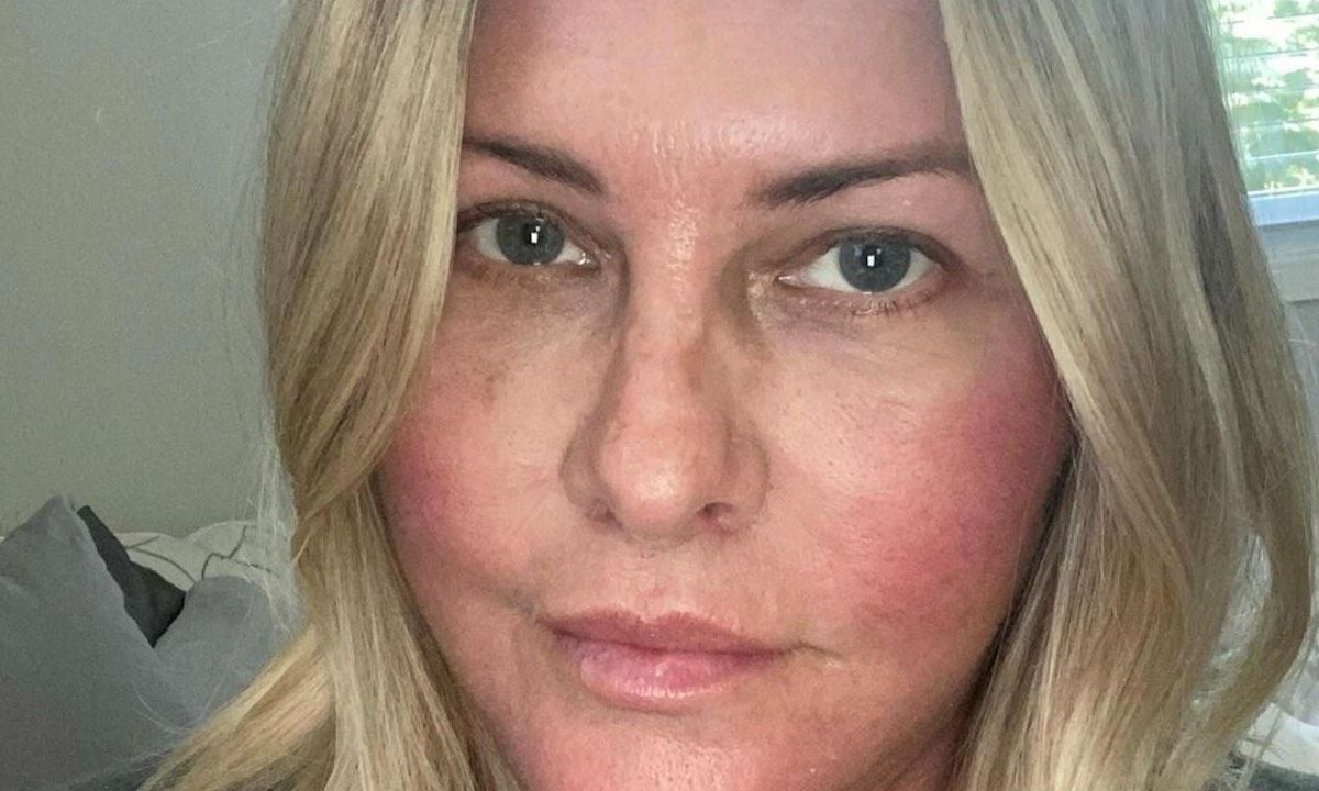 Bekende Baywatch-actrice Nicole Eggert heeft borstkanker