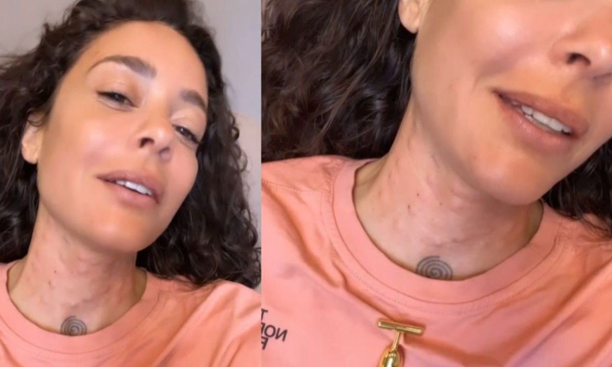 Fajah Lourens laat haar hals straktrekken in kliniek, maar resultaat is schrikbarend