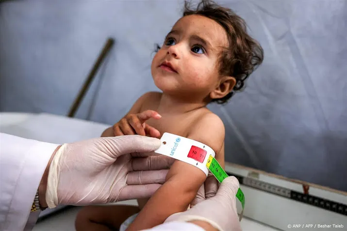 Hulporganisatie: bijna kwart van baby's in Gaza acuut ondervoed