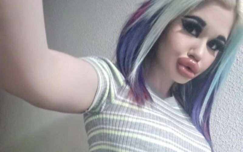 Vrouw (24) met grootste lippen ter wereld: “Nu wil ik een gezichtsverlenging”