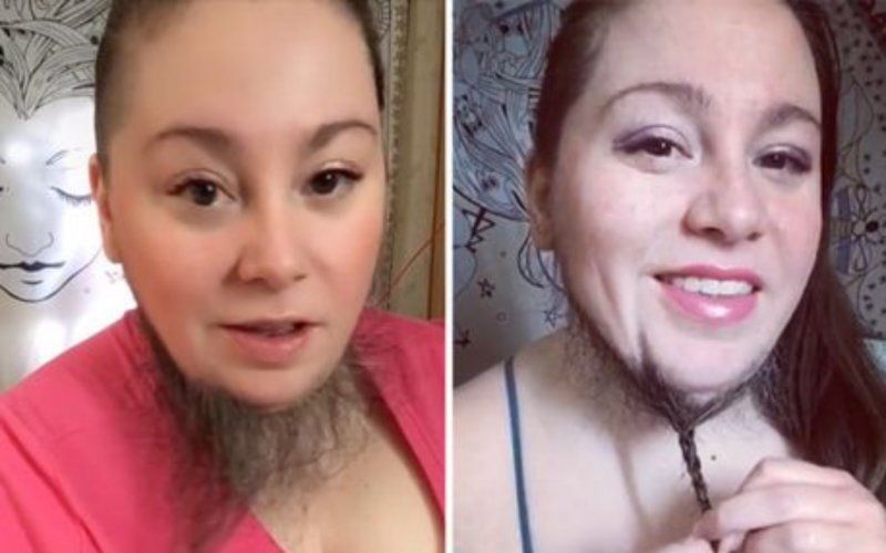 Vrouw (36) laat baard groeien: “Eindelijk stoort het me niet meer”