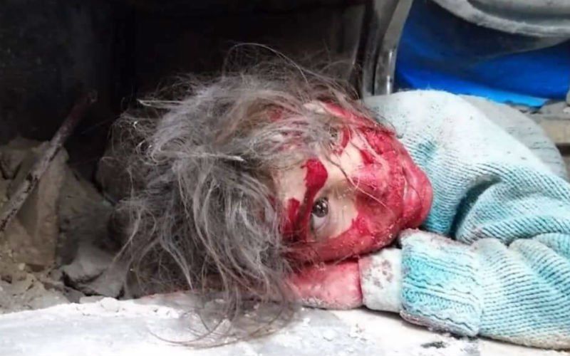 Verschrikkelijke beelden uit Syrië Helemaal bebloed meisje ligt naast haar dode zus
