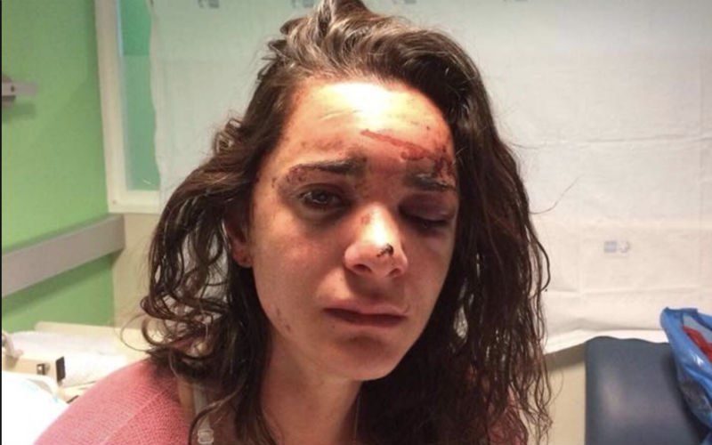 Andrea (27) werd gruwelijk verkracht: "Hij sloeg me in mijn gezicht, keer op keer"