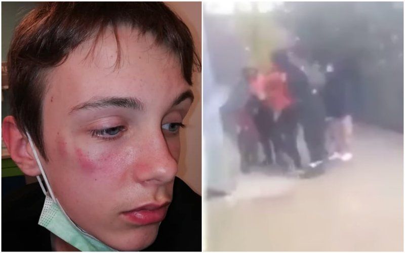Kylian (14) zwaar toegetakeld door groepje jongeren in Keerbergen: "Hier zijn geen woorden voor"