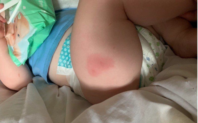 Kind van 1 jaar loopt verwondingen op na slapen op matras van Aldi