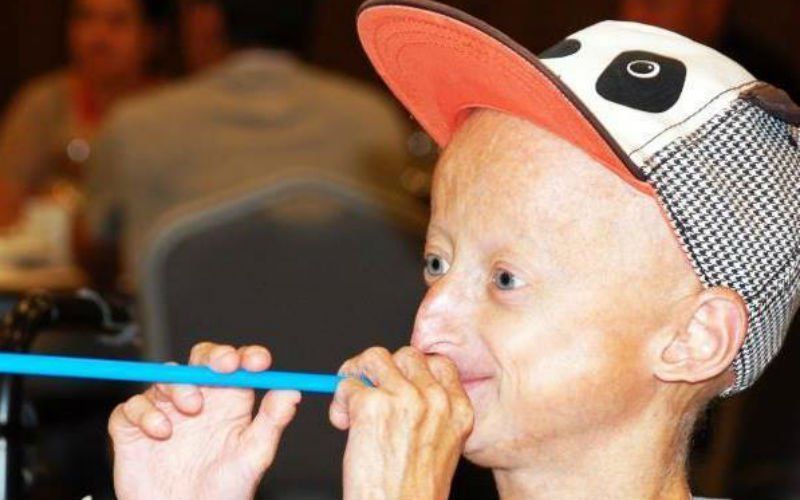 Progeria-patiënt Michiel over groot verlies: "Ze konden hem niet meer redden"