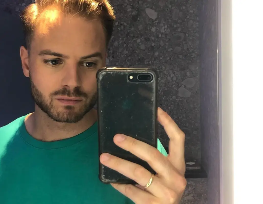 Bizar! Jim Bakkum is onherkenbaar met zijn nieuwe look
