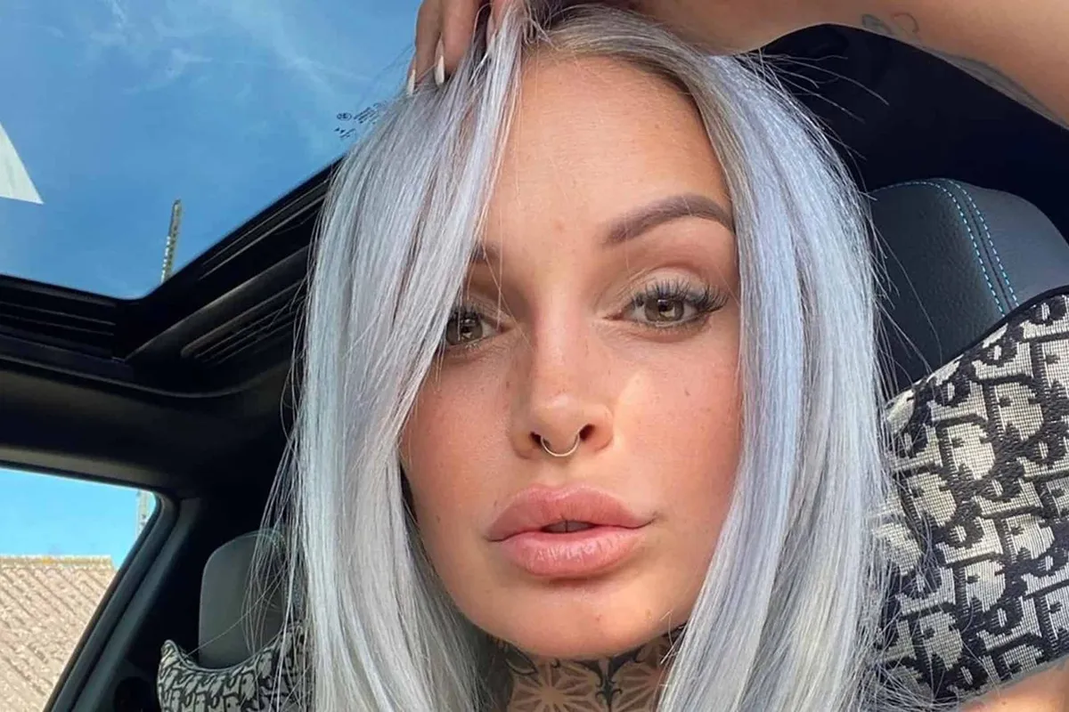 "Ik zie er niet uit!": 'Temptation'-Pommeline deelt eerlijke foto dag na pijnlijke laserbehandeling