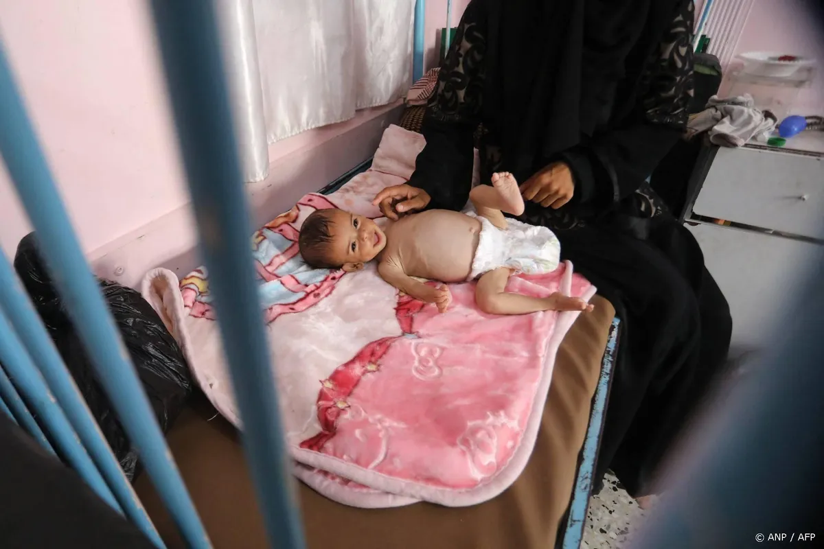 UNRWA: een op de vijf kinderen in Gaza-Stad ondervoed