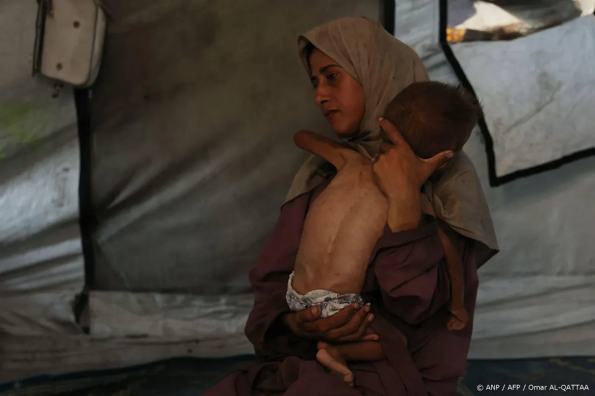 Artsen zonder Grenzen: kwart van Gazaanse kinderen ondervoed