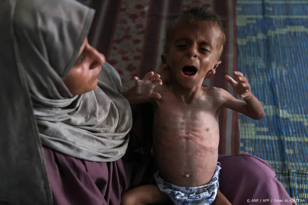 Bijna 150 doden door ondervoeding en verhongering in Gaza