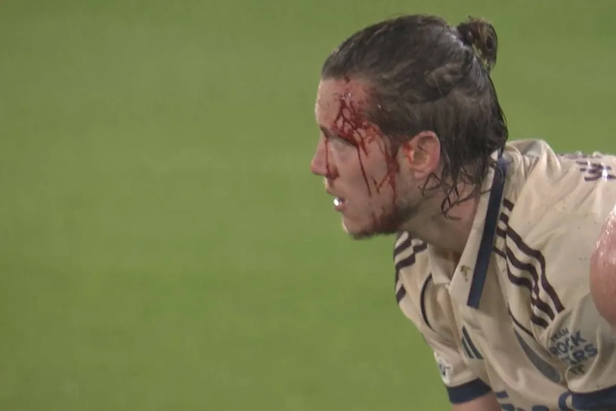 wout-weghorst-bloed-chelsea-ajax-2025