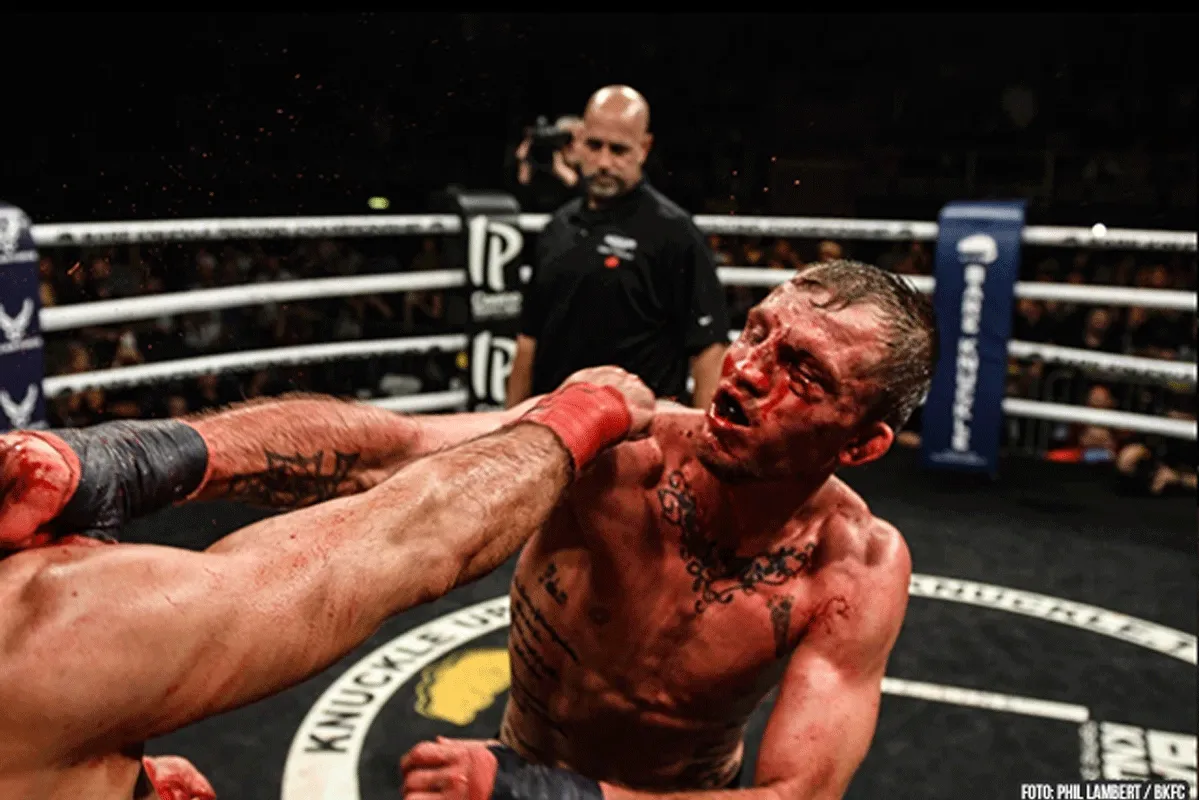 Bare Knuckle Boksen is veiliger dan andere vechtsporten