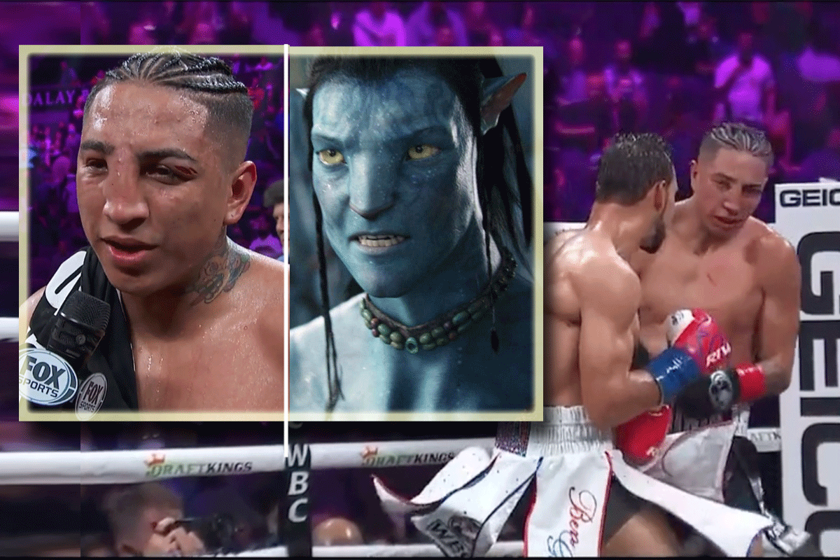 Gezicht bokser tot 'Avatar' geslagen tijdens wedstrijd (video)
