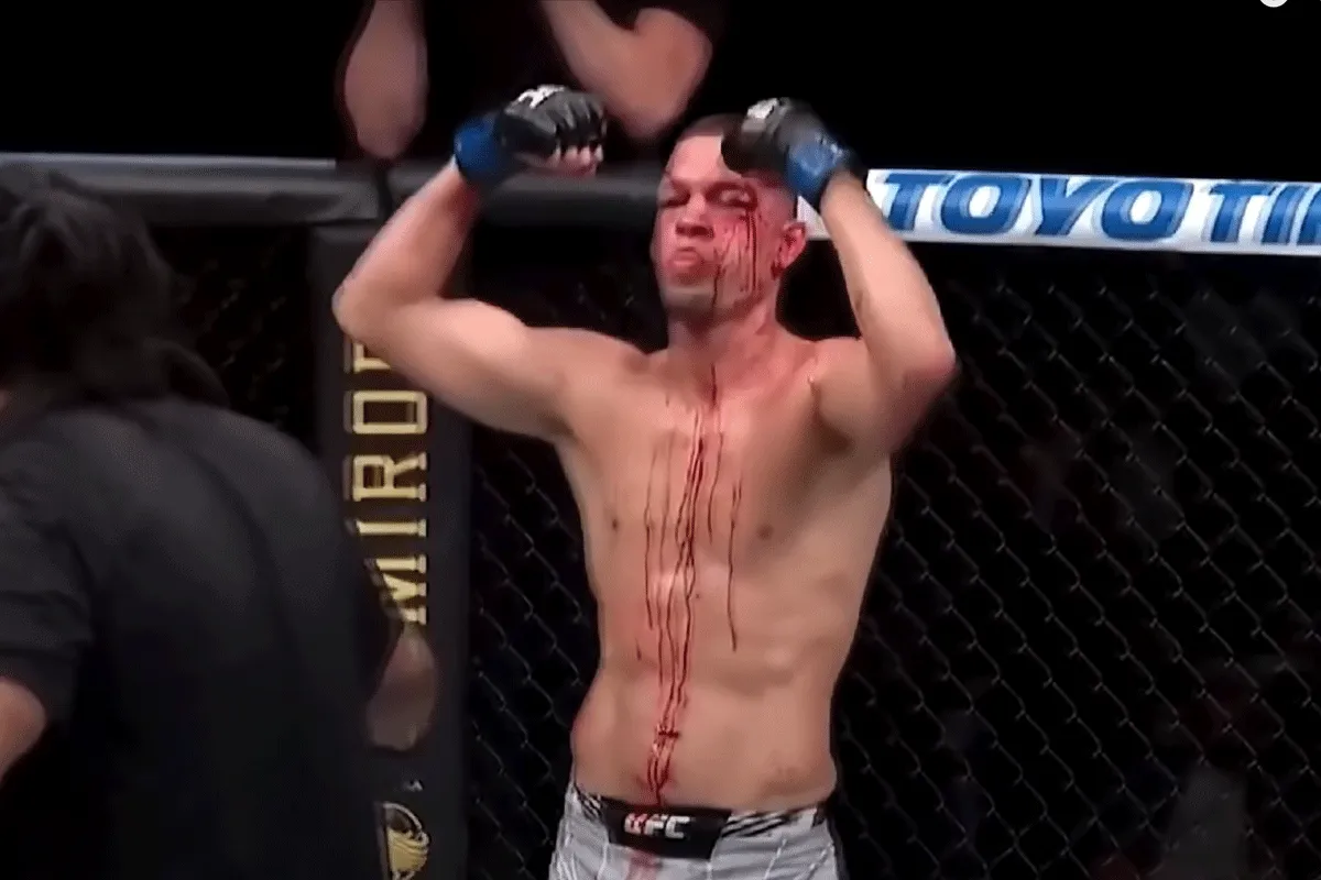 Topknokker Nate Diaz wil vechten! 'Stop met spelen'