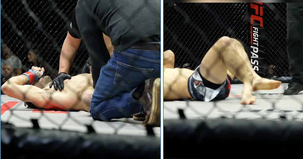 'Niet kijken!' MMA-vechter breekt been tijdens titelgevecht (video)