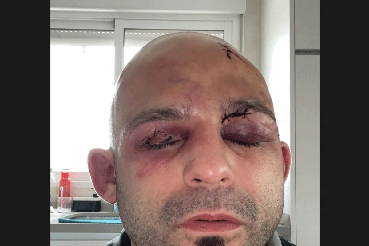 Bokser Kiko Martinez: 'Gezicht kapot door kopstoten van Josh Warrington'