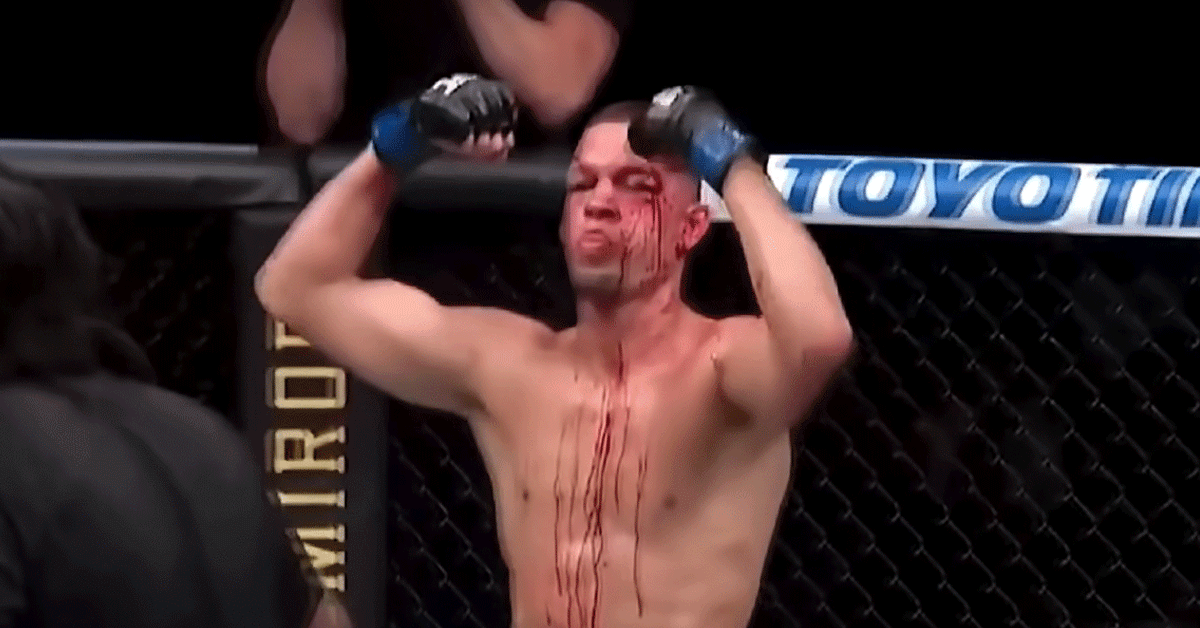 UFC-ster Nate Diaz mept kerel dikke wang bij Jake Paul bokswedstrijd! (video)