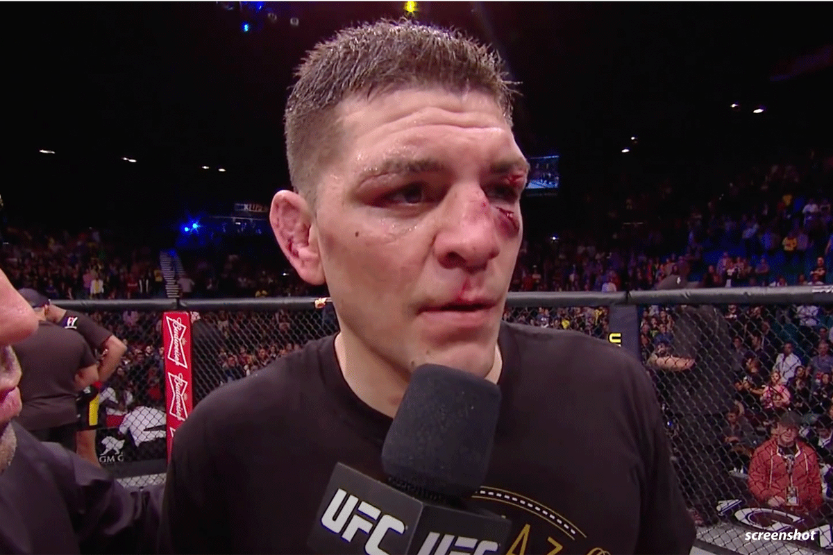 UFC brengt beruchte Nick Diaz terug in 2022: 'Broer Nate treft McGregor'